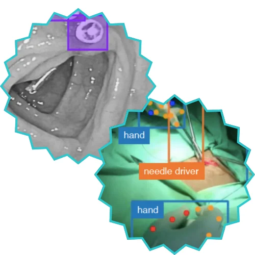 AVOS annotated videos of open surgery , ai in healthcare