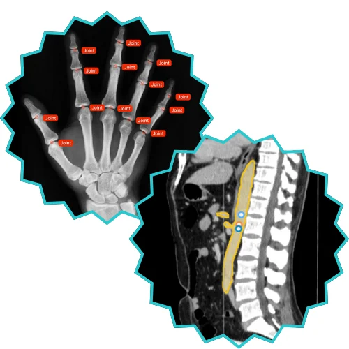 radiology image annotation, radiology report example