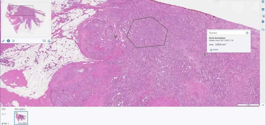 Medical Annotation Company | Data Labeling Services | AI In Healthcare